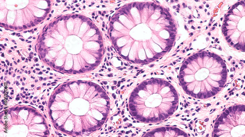 Photomicrograph (microscopic image) of a cross section of colonic mucosa tangentially sectioned. 