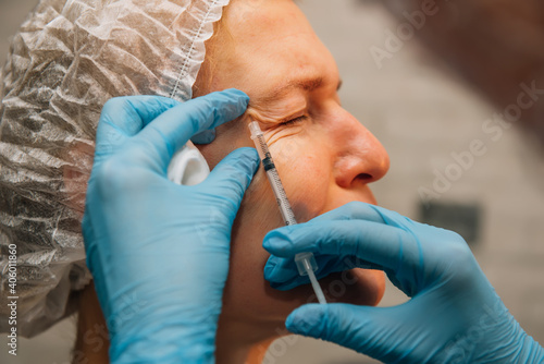 Middle-aged woman with crow's feet wrinkles around her eyes undergoing rejuvenation procedure using hyaluronic acid filler injections. Cosmetologist injects botulinum toxin for smooth face skin.