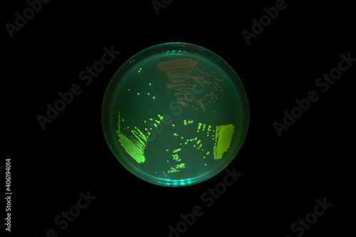 Petri dish of bacteria expressing fluorescent proteins under blue light; E. coli expressing GFP, RFP, and YFP