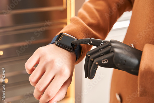 Woman with prosthesis arm checking something at the smartwatch