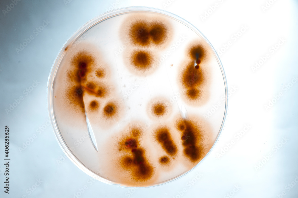 image of bacteria in laboratory placed in a receptacle