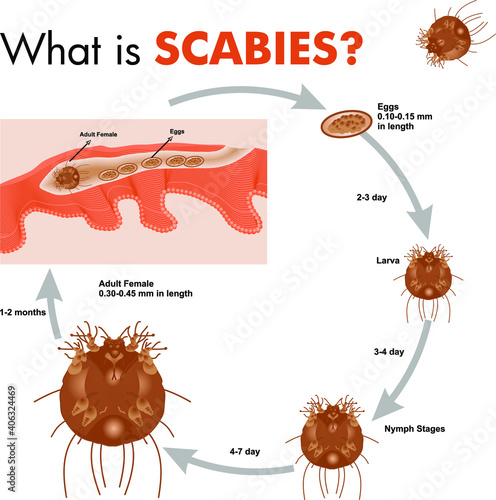 Scabies Disease poster creative design