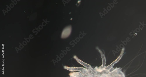 dust mites in Darkfield tissue under the microscope 100x photo