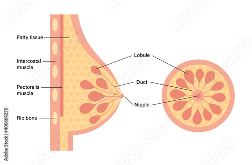 Breast disease concept