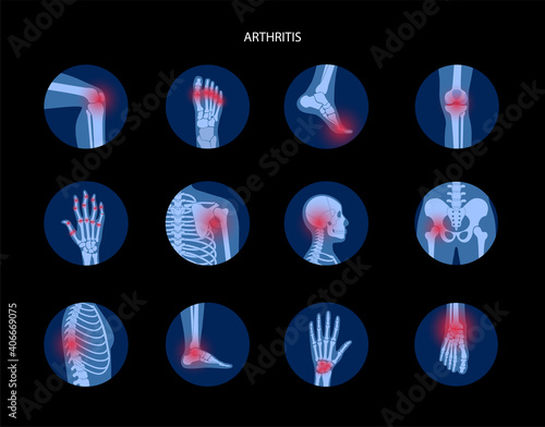 Human bones concept