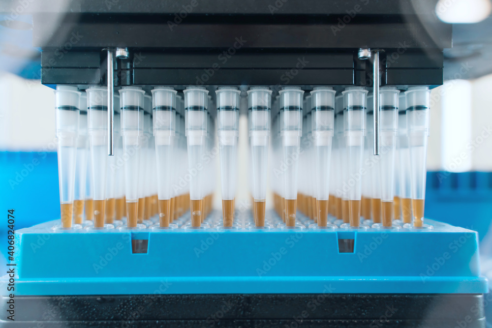 Automation in the clinical laboratory. Pipetting robot laboratory. Medicine robotics. Research and science background