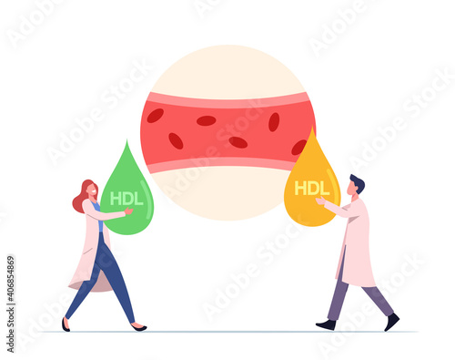 Health Care Concept. Tiny Medic Characters at Huge Human Blood Artery Holding Good and Bad HDL Cholesterol Drops
