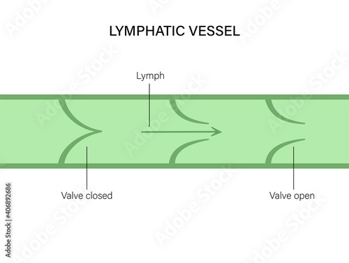 Lymphatic vessel concept