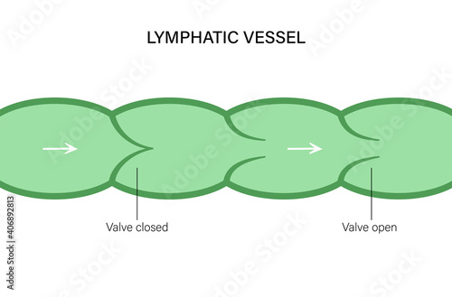 Lymphatic vessel concept