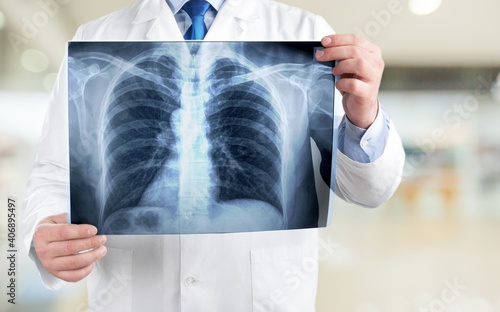 Photos Young man doctor holding x-ray