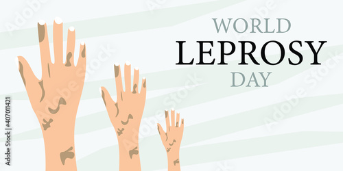 Fototapeta Naklejka Na Ścianę i Meble -  World Leprosy day vector illustration, January 31.