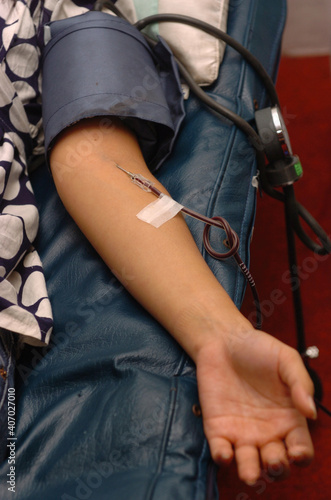 close up image of Asian man's arm while donating blood.