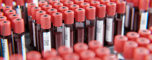EDTA Serum Blutproben Röhrchen in Labor photo