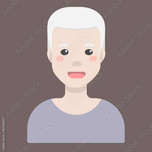 Flat cartoon vector illustration, that displays people pigmentation features. The man avatar with albinism. 16 November - the International Day of Tolerance