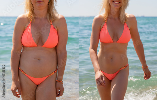 Fototapete Candid photos of a woman before and after weight loss