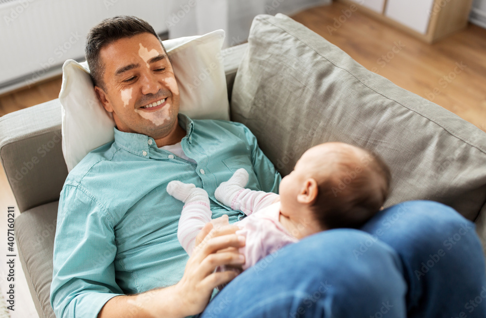 © Syda Productions - skin health, family and fatherhood concept - happy smiling middle aged father man with vitiligo on his face playing with little baby daughter lying on sofa at home