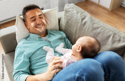 skin health, family and fatherhood concept - happy smiling middle aged father man with vitiligo on his face playing with little baby daughter lying on sofa at home photo