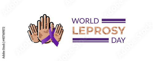 World Leprosy Day vector illustration with purple awareness ribbon and hands in MBE Style.