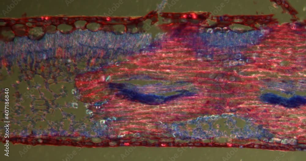 gumtree leave in Darkfield tissue under the microscope 100x 素材庫影片