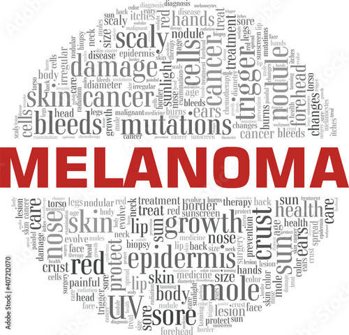 Melanoma vector illustration word cloud isolated on a white background.