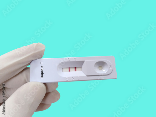 Biochemist or Lab Technologist holds a test device or cassette for Troponin T-test. Rapid screening test, myocardial infarction. Medical testing concept. photo