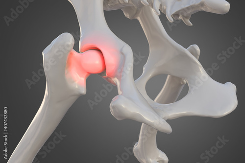 Canine dysplasia dog bones