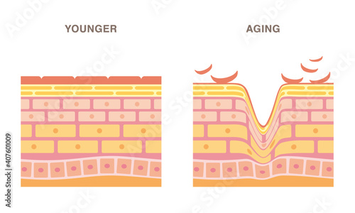 Skin cross section. Younger and aging. Smooth and wrinkled. Pale colored illustration in flat cartoon style.