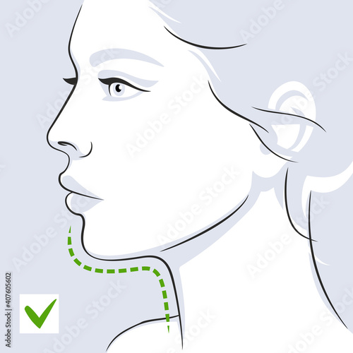 Woman profile double chin after. Woman face. Vector illustration