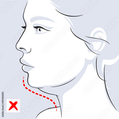 Woman profile double chin before. Woman face. Vector illustration