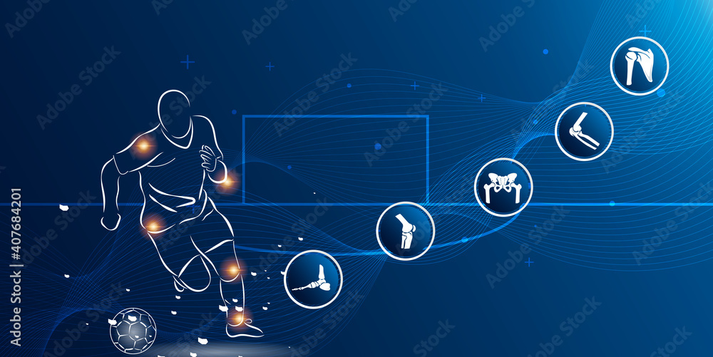 Medical infographic orthopedic. Human silhouette in football motion injury sport.Vector illustration