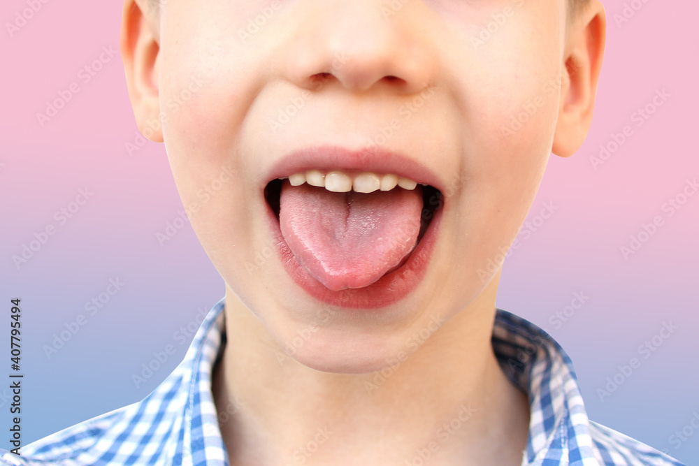 boy, kid performs articulation exercises for mouth, concept of speech disorders, correction, frenum of tongue, methods of correctional development boy, kid performs articulation exercises for mouth, concept of speech disorders, correction, frenum of tongue, methods of correctional development