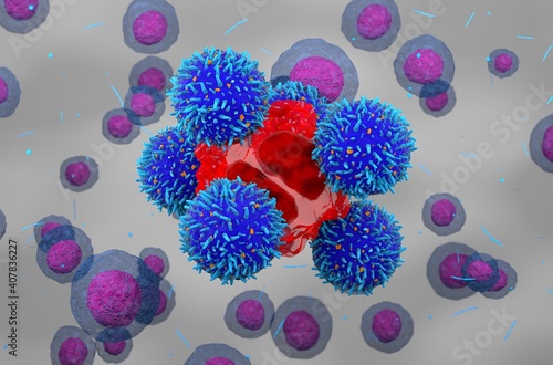 3d illustration CAR T-cells destroy cancer cell photo