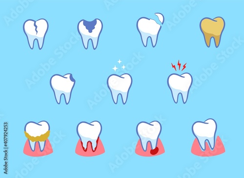 Dental diseases set. Teeth problems, different injuries. Infographics in dentistry. Collection of icons. cartoon style