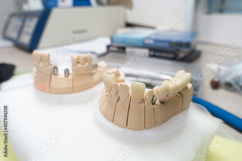 workplace of a dental technician for the manufacture of dental prostheses photo