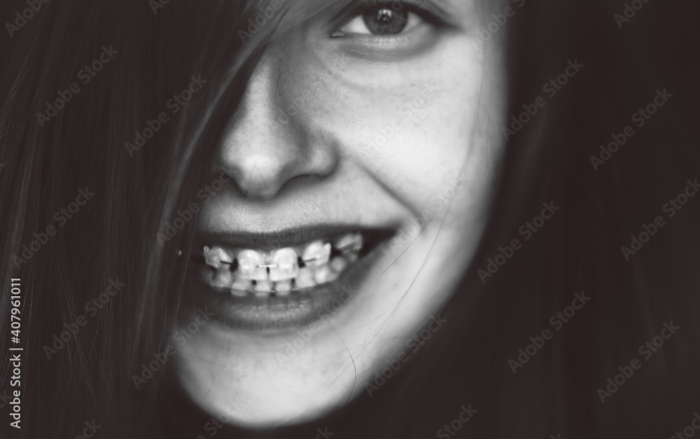 Portrait of a young cheerful girl with braces system