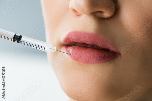 Aesthetic Face Lift Filler Injection