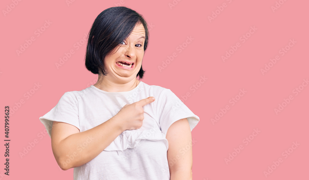 Brunette woman with down syndrome wearing casual white tshirt pointing aside worried and nervous with forefinger, concerned and surprised expression Brunette woman with down syndrome wearing casual white tshirt pointing aside worried and nervous with forefinger, concerned and surprised expression
