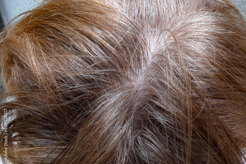 Gray hair appeared on the woman head. Regrown hair roots before dyeing.