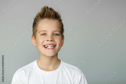 The child smiles and shows jagged teeth. Dental medicine and healthcare
