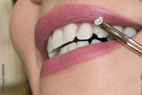 Dentist doctor select a gem or rhinestone for the patient’s teeth, Mouth close up