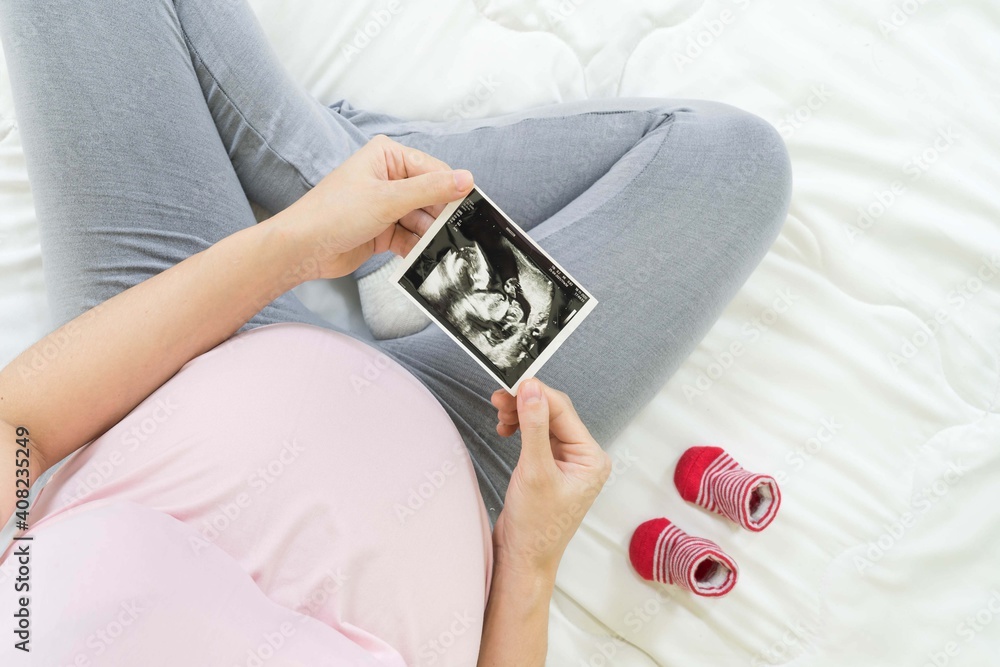 Top view of pregnant woman sitting on bed,holding x-ray image of her baby with shoes .Concept of pregnancy, Maternity prenatal care. Mom with a new life Top view of pregnant woman sitting on bed,holding x-ray image of her baby with shoes .Concept of pregnancy, Maternity prenatal care. Mom with a new life