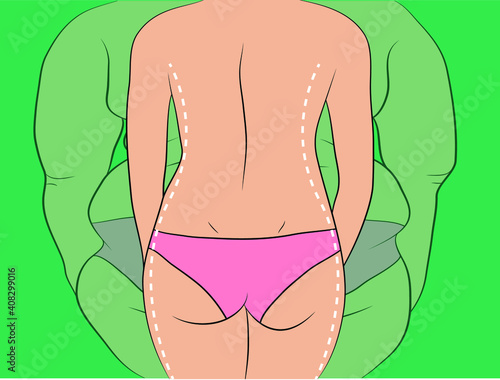Woman body and back fat before and after weight loss