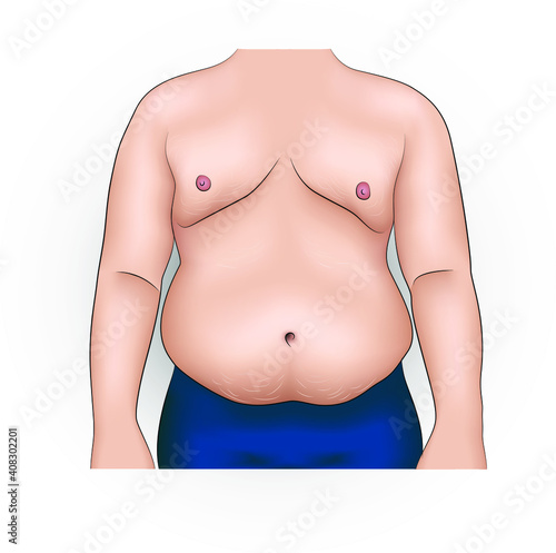 Realistic vector illustration of a man with obesity and fat belly