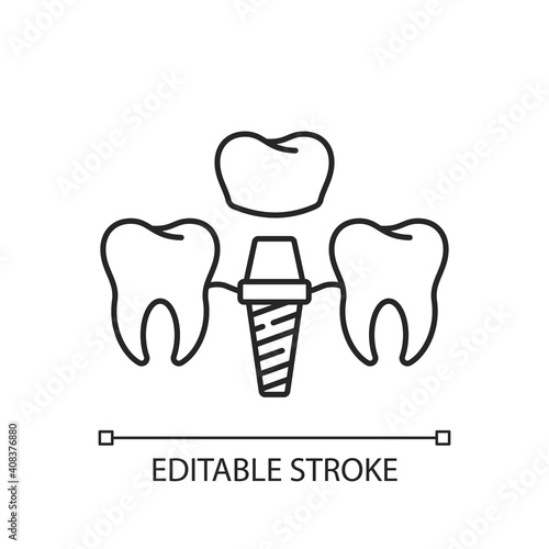 Dental implants procedure linear icon. Tooth recovery process. Dental surgety. Thin line customizable illustration. Contour symbol. Vector isolated outline drawing. Editable stroke
