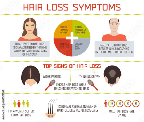 Hair loss symptoms infographic elements. Female and male pattern hair loss set. Hair care concept. Hair loss clinic concept design. Vector illustration.