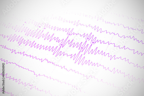 Results of electroencephalogram on paper, diagnostics of epilepsy photo