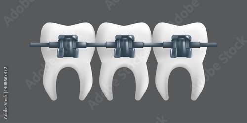 Teeth with metal braces. Orthodontic treatment concept. 3d realistic vector illustration of a dental ceramic model isolated on a grey background