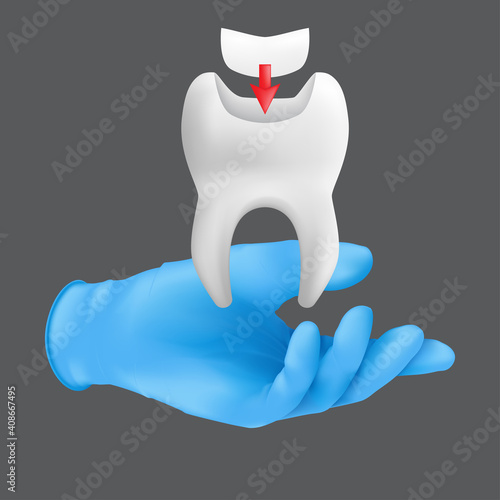 Dentist hand wearing blue protective surgical glove holding a ceramic model of the tooth. 3d realistic vector illustration of dental fillings concept isolated on a grey background