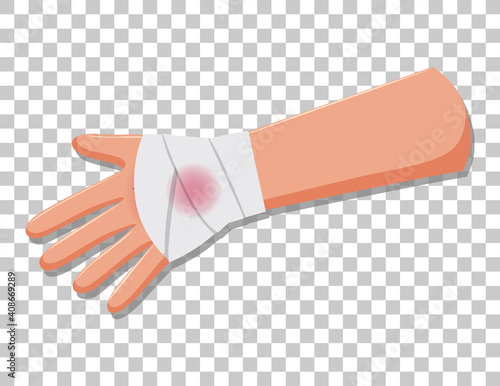 Injury arms with gauze on transparent background