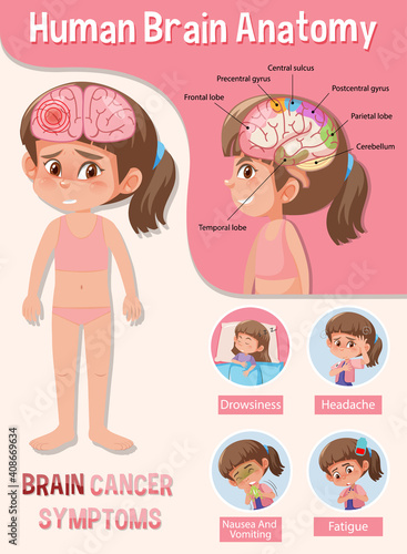 Information poster of human brain diagram